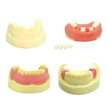 Dental Joylashtiradigan Tish Model Dental O'qitish O'rganish Model Dental Joylashtiradigan Dental Asbob