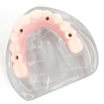 Dental og'zaki model Malone bridge protez tiklash va dental joylashtiradigan Simulasyon namoyish o'qitish model